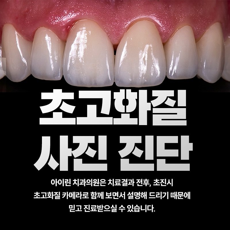 아이린치과 인스타그램 게시물