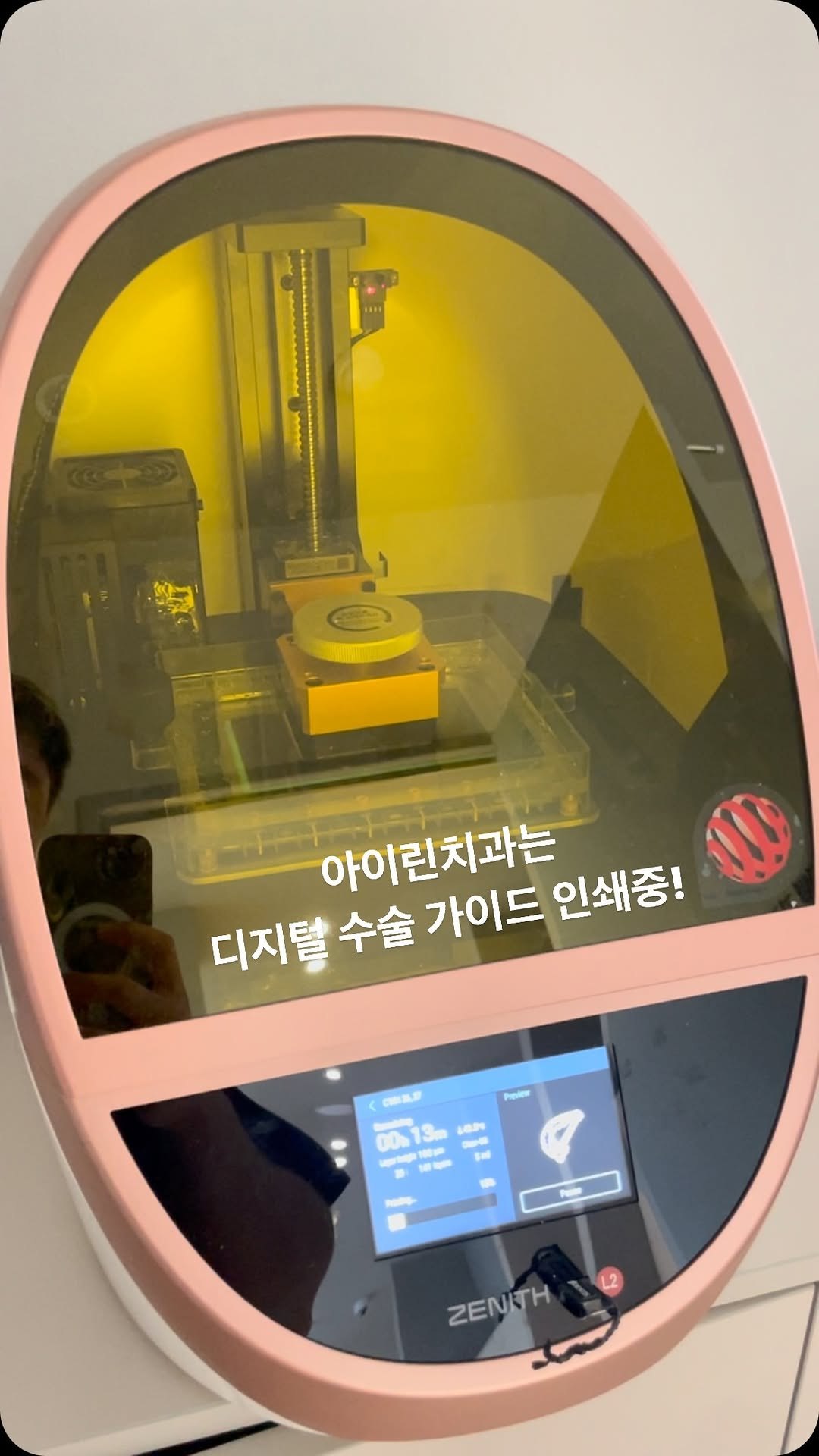아이린치과 인스타그램 게시물